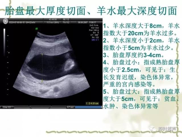 中孕期胎儿超声检查规范切面