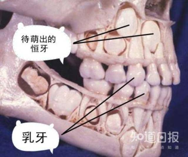 做了半辈子牙医可能都没见过的牙齿情况!