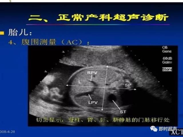 中孕期胎儿超声检查规范切面