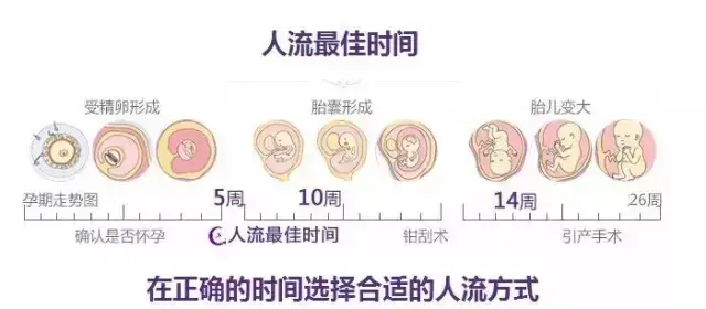 郑州新世纪医院医生提醒:引产≠人流!每个女性都该重视