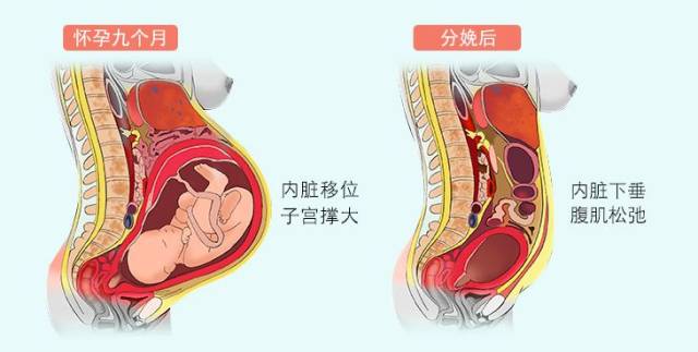 生完孩子后 原本饱和的腹腔突然腾空 被挤压的内脏因失去支撑而