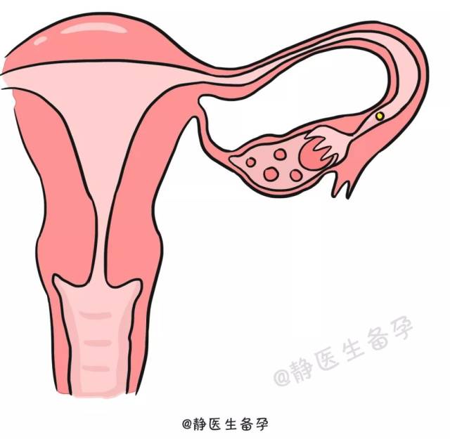 卵泡的由来 每个正常的女性有两个卵巢,主要功能为产生卵子和分泌性