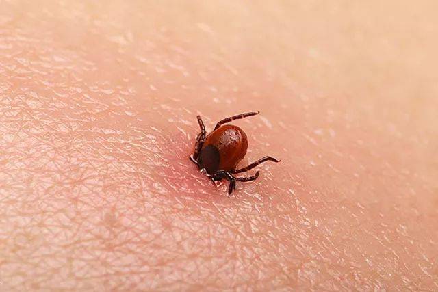 蜱虫钻进4岁男孩后脑勺,每年都有人因这种虫丧命!