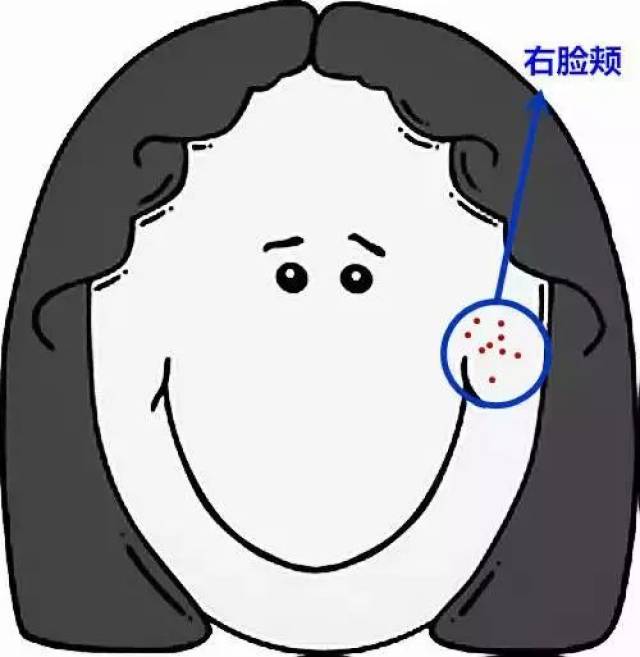 脸上的痘痘告诉你,身体哪里出了问题!