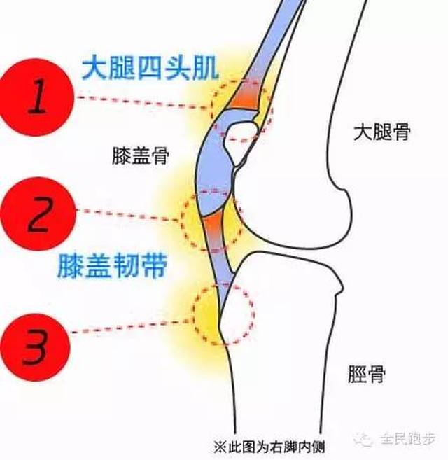 1&2.膝盖韧带炎(弹跳膝)