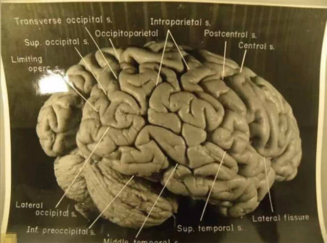 爱因斯坦病逝,大脑被医生私自带走,被切240块后还在动