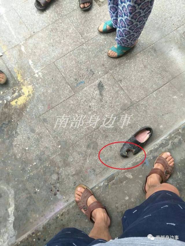 钢管掉落砸中路人致头部受伤脚趾截断(视频)