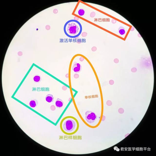 脑脊液单核巨噬细胞的别样风情