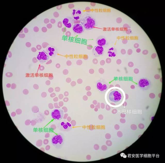 脑脊液单核巨噬细胞的别样风情