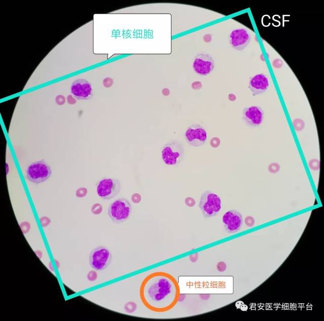 脑脊液单核巨噬细胞的"别样风情"