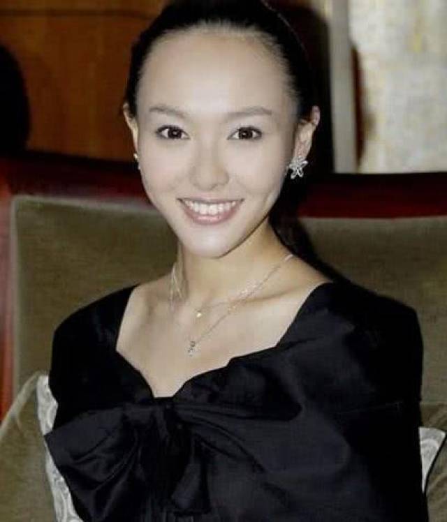 陈乔恩发际线秃了一块?这些女星们除了植发,只