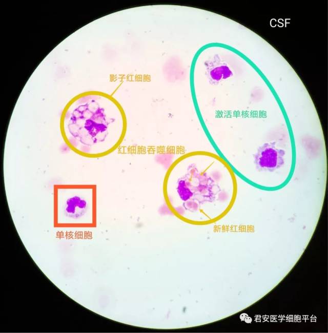 脑脊液单核巨噬细胞的"别样风情"