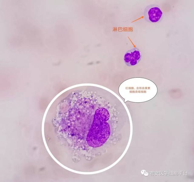 脑脊液单核巨噬细胞的"别样风情"