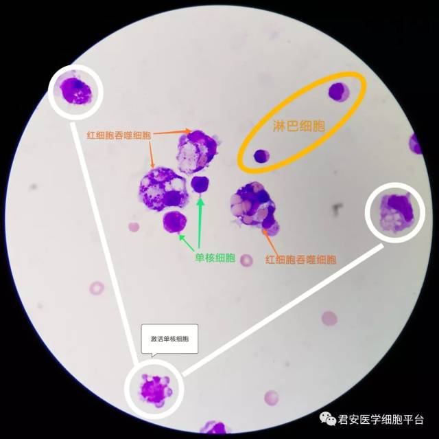 脑脊液单核巨噬细胞的"别样风情"