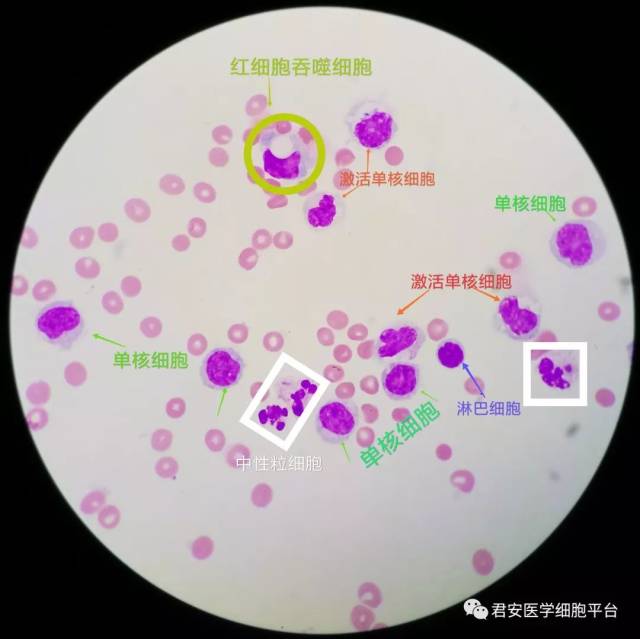 脑脊液单核巨噬细胞的"别样风情"