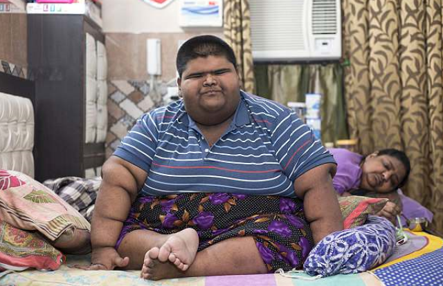 世界上最胖男孩减重成功 体重曾超过237公斤