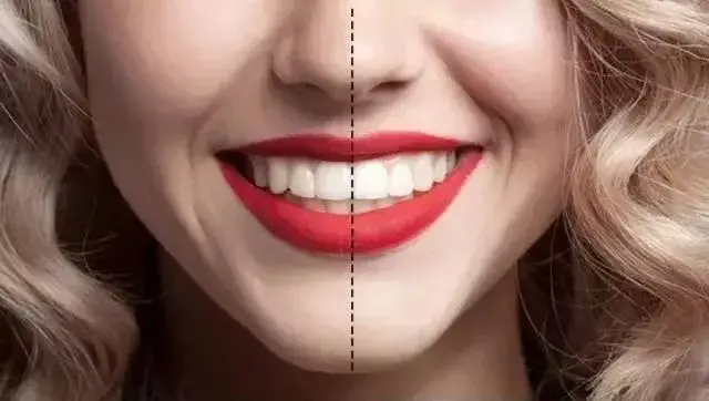 (对着镜子用牙线将面部中线与牙齿中线相对比,中线一致说明牙齿整齐)