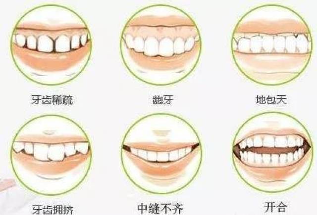 门牙是哪几颗 搜狐网