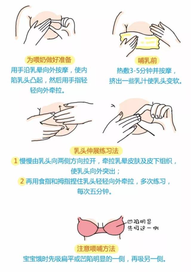 孕妈贴士 | 母乳喂养中,乳头凹陷,皲裂,胀奶怎么办?专家教您应对!