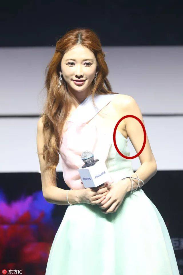 就是因为副乳!