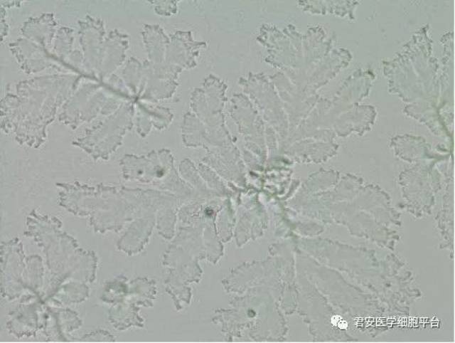 羊齿状结晶,知多少?