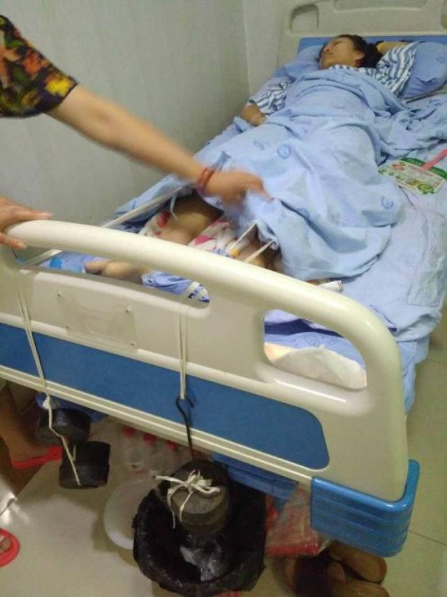 处理父亲后事途中遇车祸 川大女生双腿粉碎性骨折