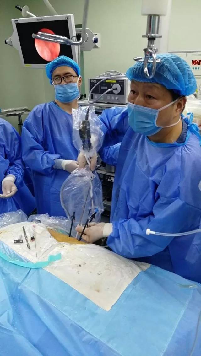 程帆教授在为四岁的肾结石患儿联合输尿管软镜进行pcnl