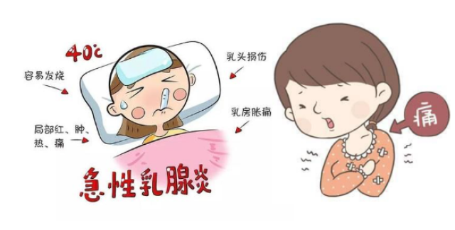 孕妇穿什么内衣 可以预防乳腺炎