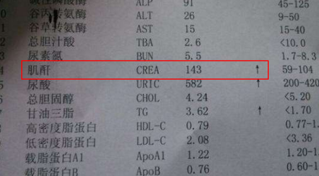 不想尿毒症的发生,肌酐的4组数据要清楚,不然后悔都来