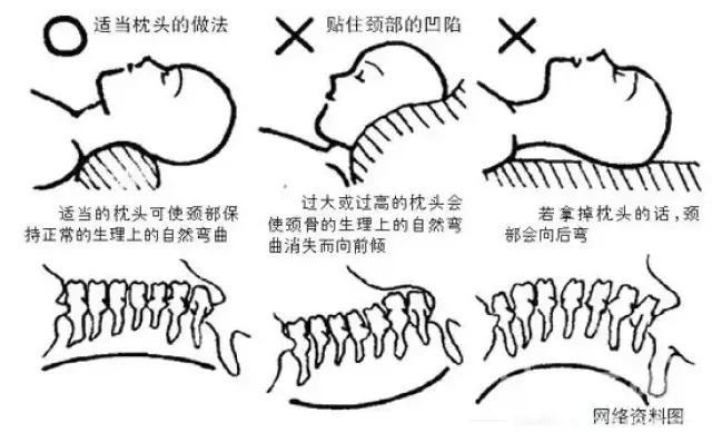 或是可以在在颈部放一个小垫子,以支持正常颈椎曲度