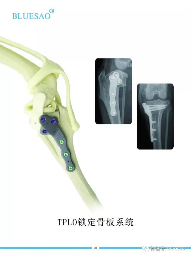 【病例分享】犬前十字韧带断裂跛行,安徽佰陆tplo系统临床病例分享