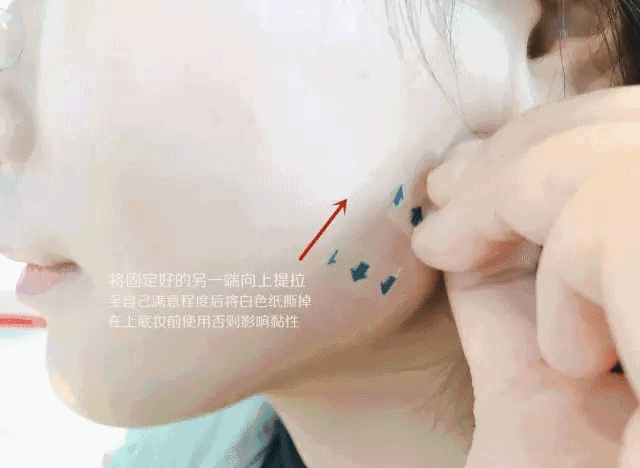 基本上就是贴在脸上的 大力透明胶……能把肉使劲的扥上去.