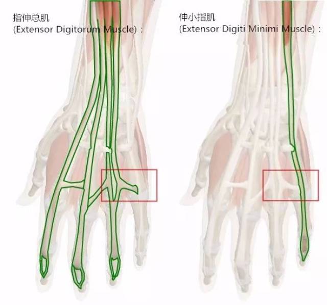 可以看到 驱动四指和五指的伸肌腱是有 分叉连接的(红框处)