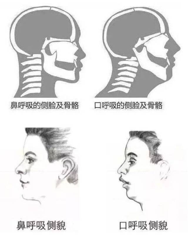 睡觉打呼80%可能是病,三种办法教你如何停止打呼