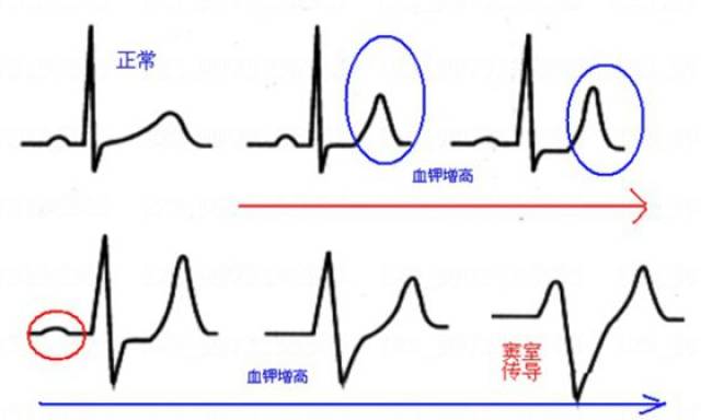 血透病人口诀_乘法口诀表图片(3)