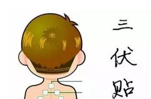 针对鼻炎的三伏贴