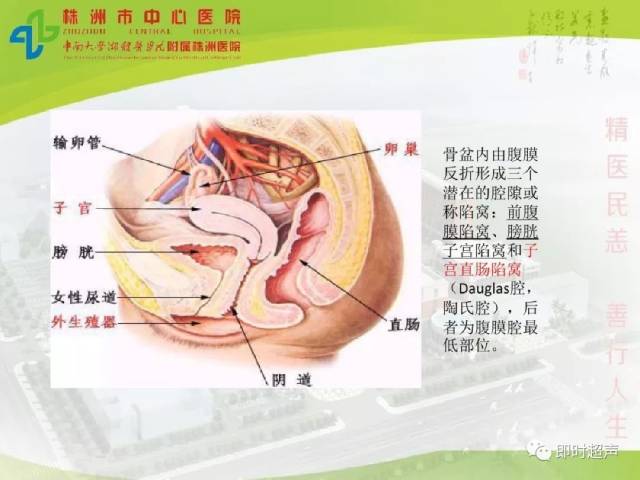 正常女性盆腔超声解剖和标准切面