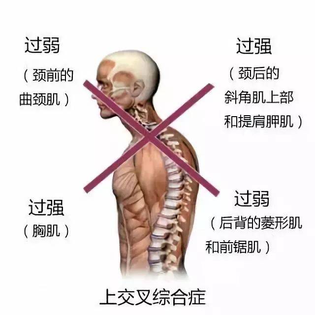 溜肩,驼背,长痘,不p图的女星简直不能看