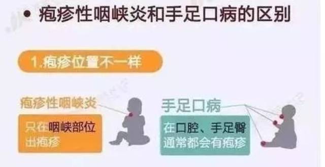 儿童疱疹性咽峡炎,手足口病仍处于高发期,要这样防治