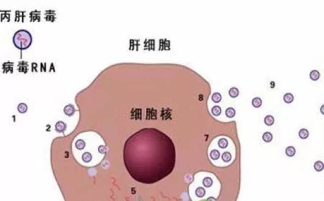 丙型肝炎病毒(hcv)是如何传播的?
