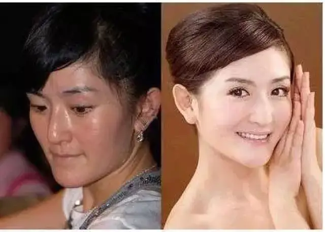 当红女明星卸了妆之后,杨颖堪比换脸,你都见过吗?