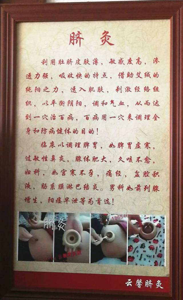 云馨脐灸特色项目之四:脐灸