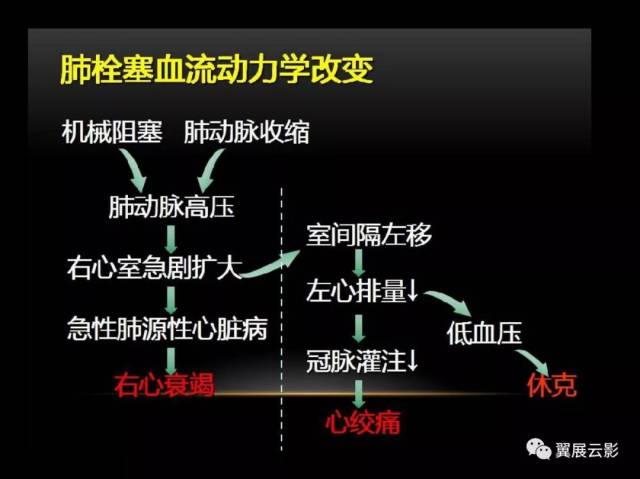 【经典回顾】肺栓塞影像诊断与鉴别