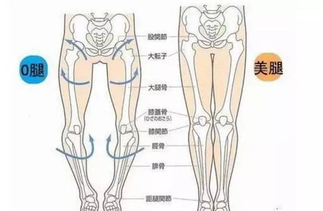 一,o型腿下肢排列特征与天生骨骼差异