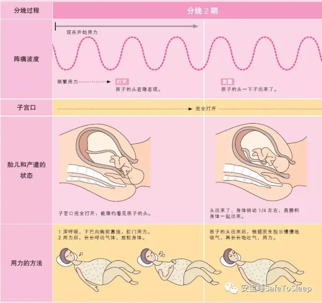 图解自然分娩过程之分娩2,3期的过程
