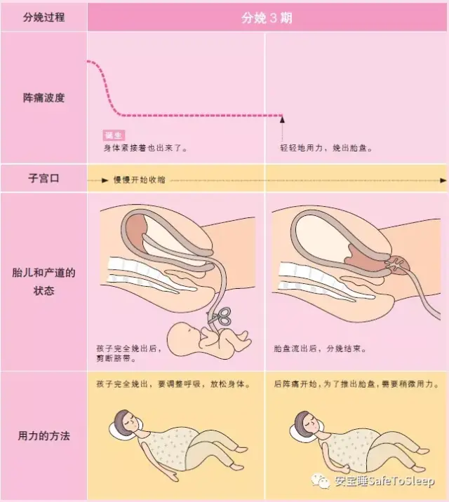 图解自然分娩过程之分娩2,3期的过程