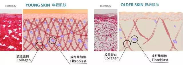 关键在于激活真皮细胞劳模【成纤维细胞 真皮里的成纤维细胞是劳模