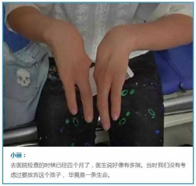 孩子生下来就有25根指头!医生一看孩子妈妈的手,瞬间明白了