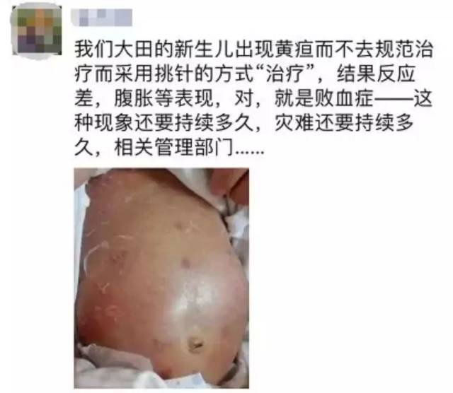 为了退黄疸,新生儿被喂了这个,结果进了重症监护室