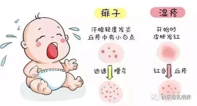 湿疹和痱子,如何区别?如何护理?